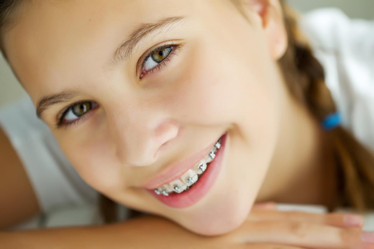 Traditional Braces Conyers, GA